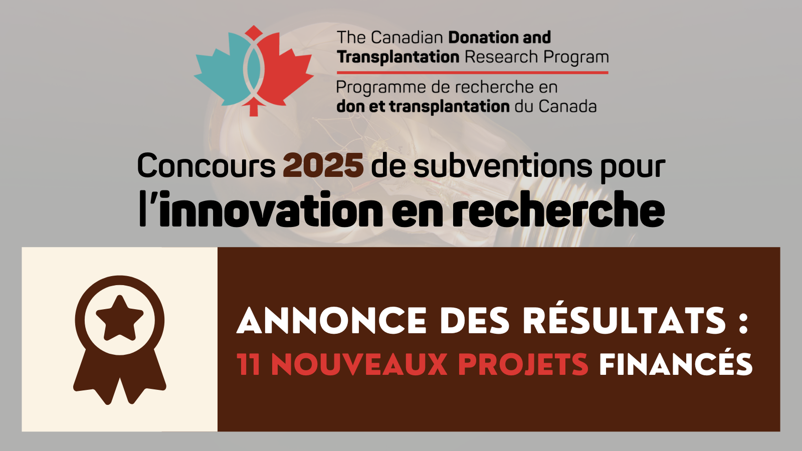 2025 Innovation Grant_Announcing the results_FR Concours de subventions pour l’Innovation en recherche